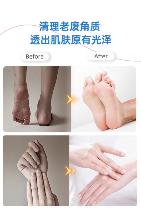 BEAR Electric Foot File 小熊电动修脚器