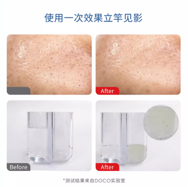 DOCO LAB Hydrodermabrasion Electric Blackhead Extractor DOCO LAB小气泡电动黑头吸出器