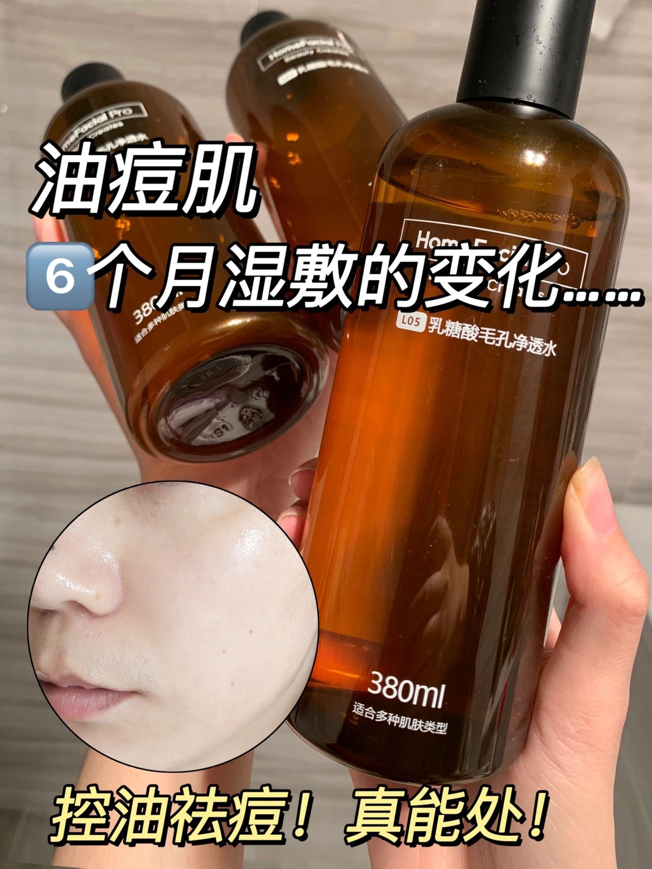 HFP Lactobionic Acid Clarifying Peeling Toner HFP乳糖酸毛孔净透水