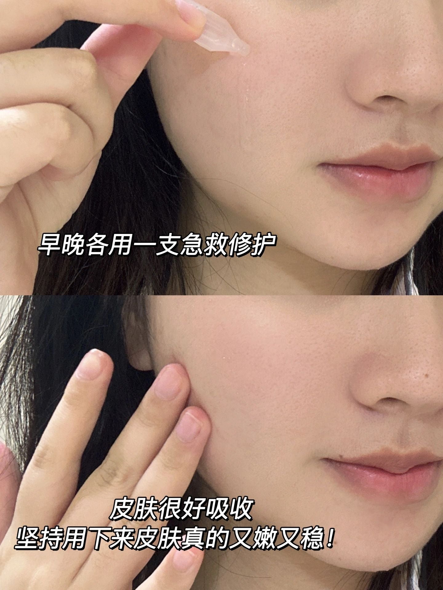 Kefumei Human-like Recombinant Collagen Restoration Single-Use Essence 可复美重组胶原蛋白次抛精华