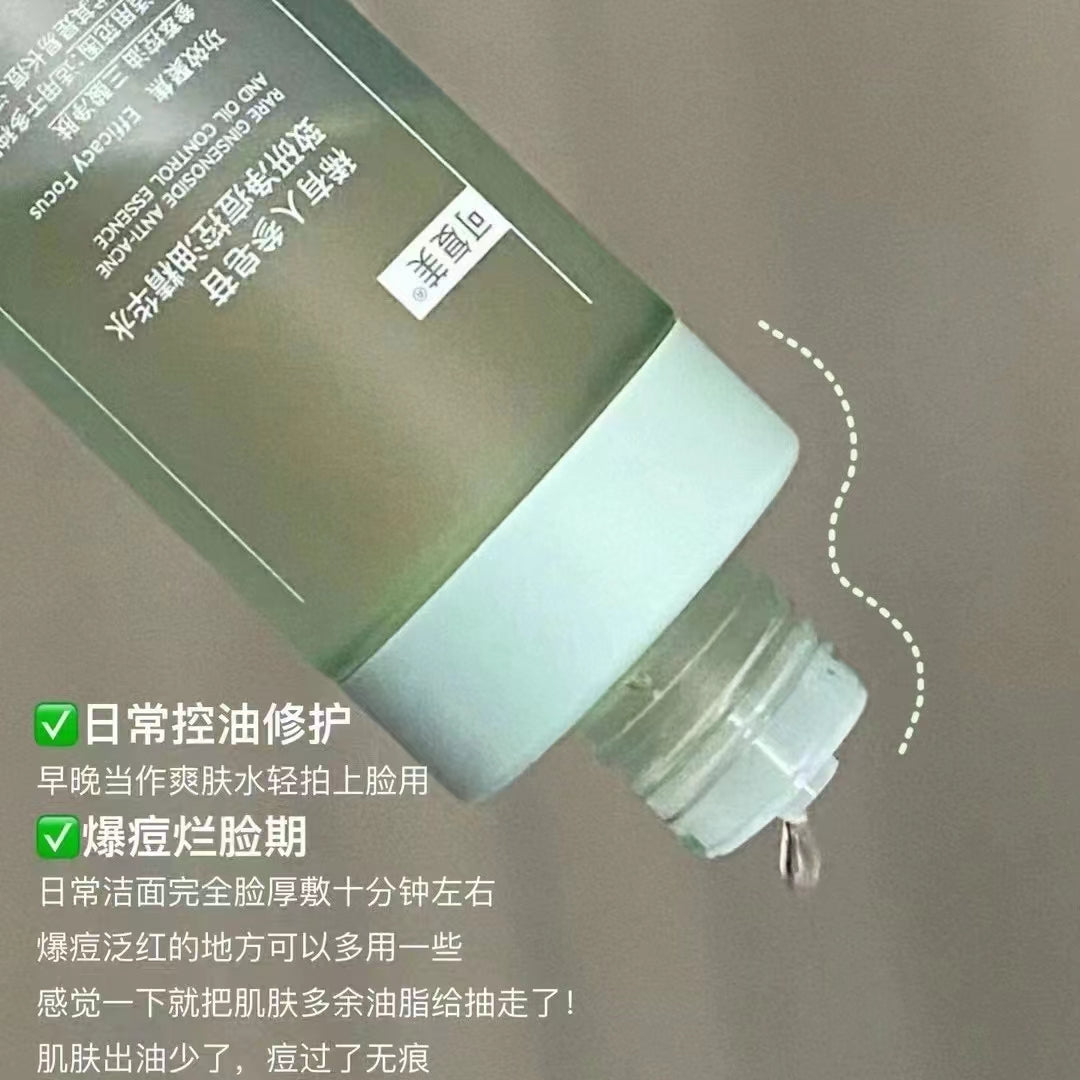 Kefumei Rare Ginsenoside Anti-acne Oil Control Essence Toner 150ml 可复美稀有人参皂苷致研净痘控油精华水