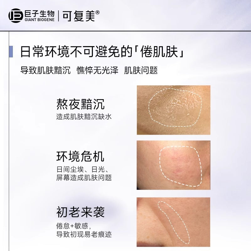 Kefumei Triple Yeast Essence Mask 可复美三重酵母精萃面膜 5pieces