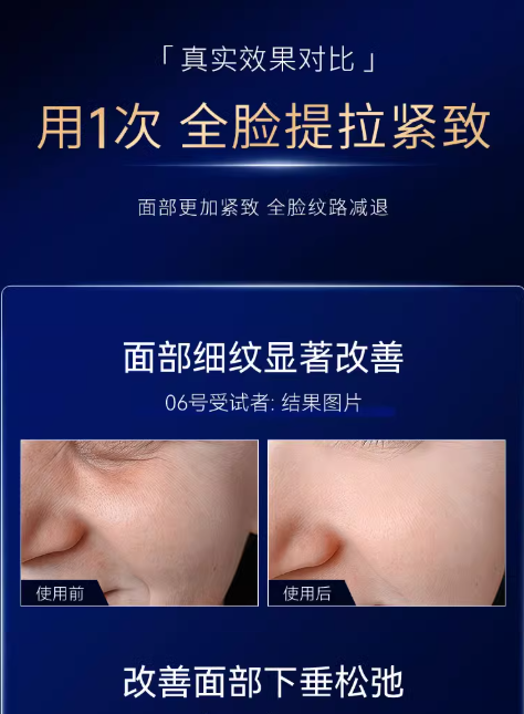 L'QUALYN Collagen Boosting Skin Rejuvenation Device 欧泉琳胶原炮嫩肤美容仪