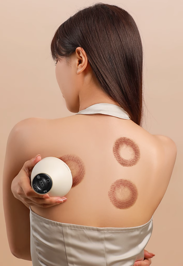 Tiktok/Douyin Hot MUSELOVE Electric Cupping & Gua Sha Massager【Tiktok抖音爆款】慕诗爱电动拔罐刮痧仪