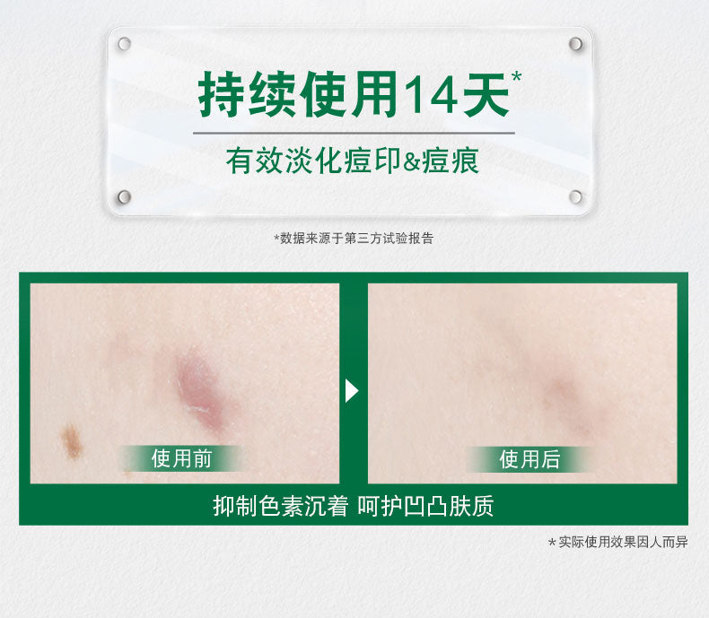 Mentholatum Acne Scar Reducing Gel 18g 曼秀雷敦乐肤洁痘痕淡化啫喱