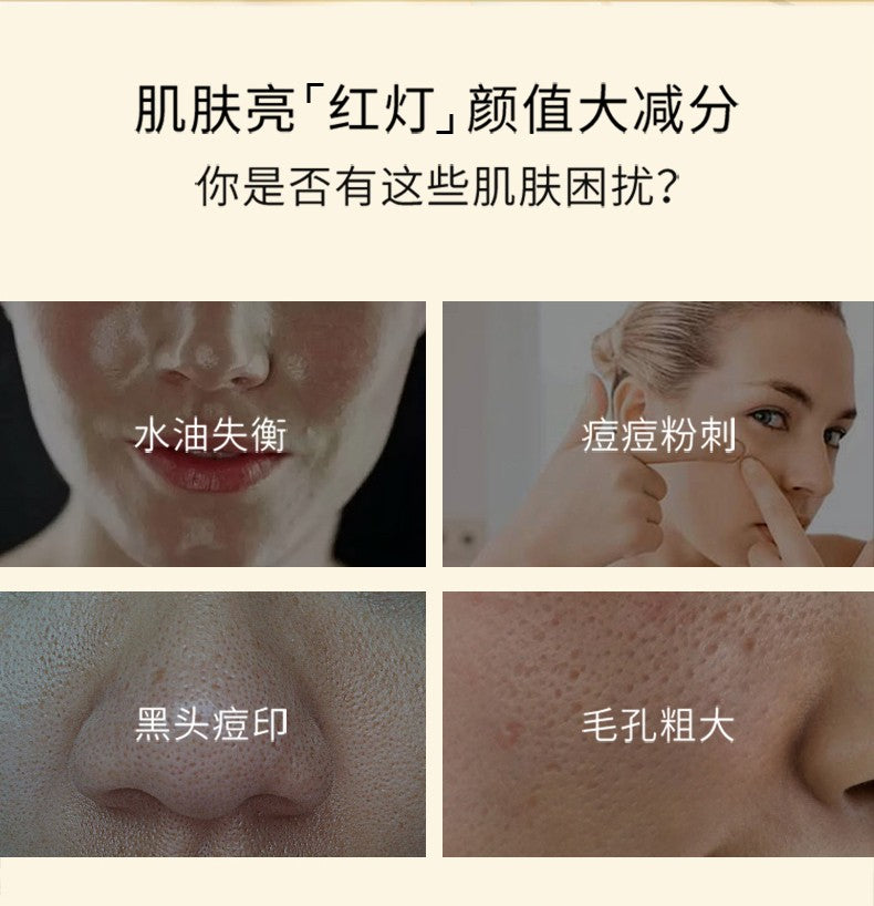 Milensea Sulfur Acne Cream Gel 20g 以色列米蓝希硫磺祛痘膏凝胶