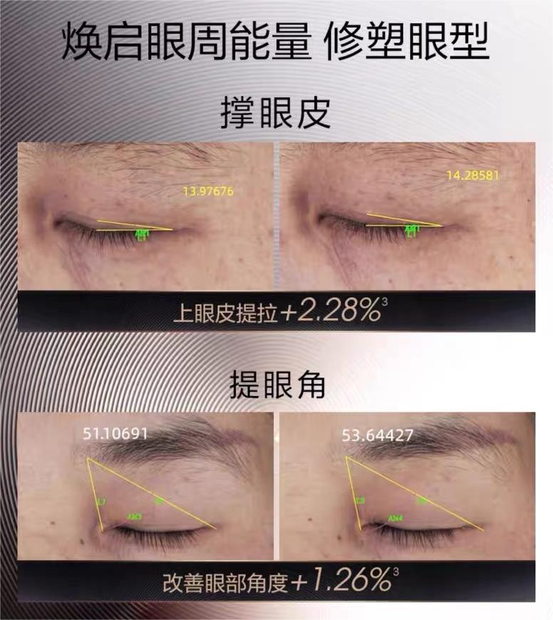 PROYA Inaugurating Intensive Anti-wrinkle Eye Cream 20g 珀莱雅启时集致抗皱眼霜