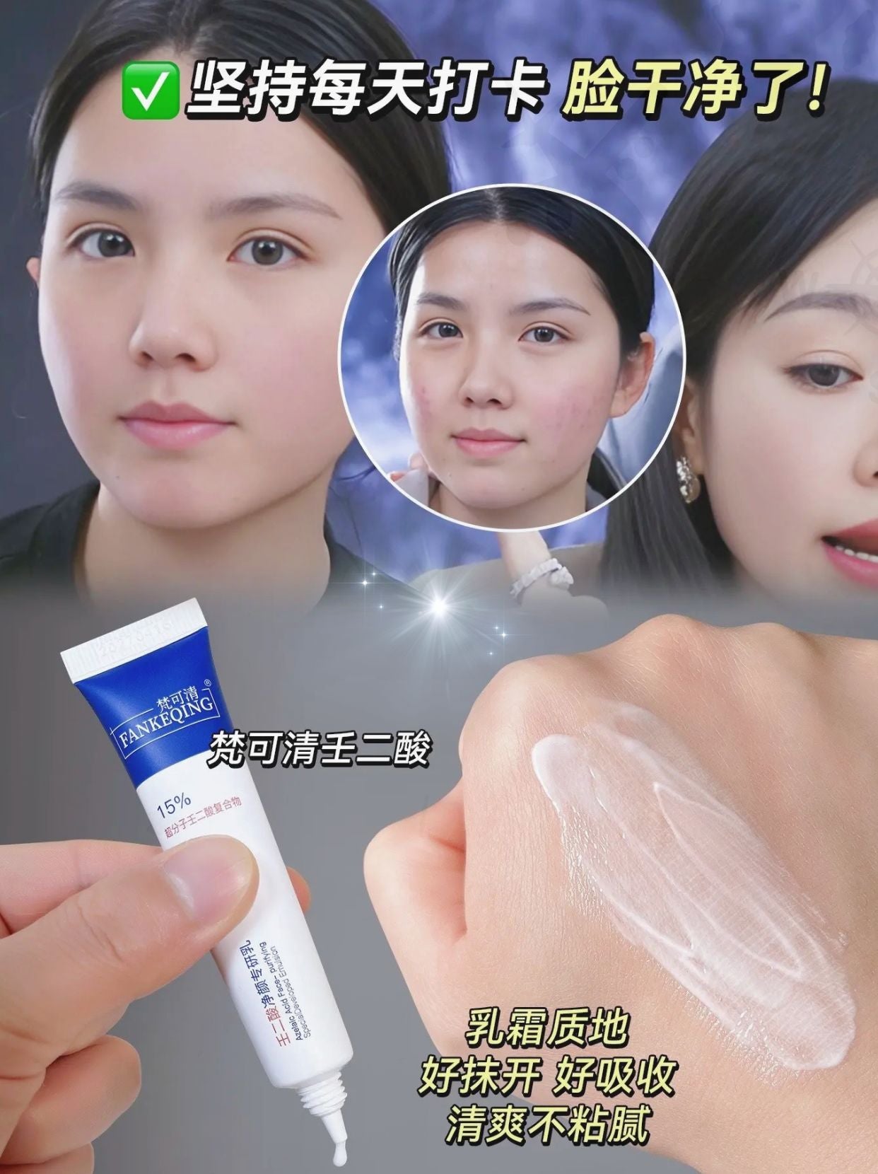 Tiktok/Douyin Hot FANKEQING 15% Azelaic Acid Clarifying Expert Emulsion 15g 【Tiktok抖音爆款】梵可清15%壬二酸净颜专研乳