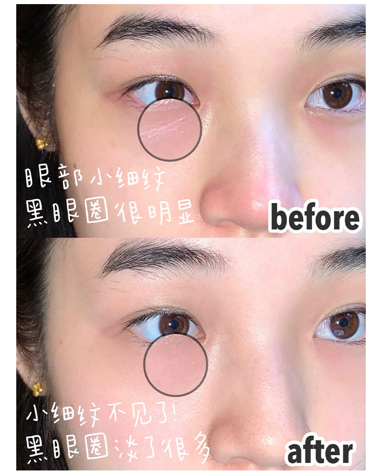 UNISKIN Second Generation Wrinkle Reducing Eye Cream 18g 优时颜二代微笑眼霜